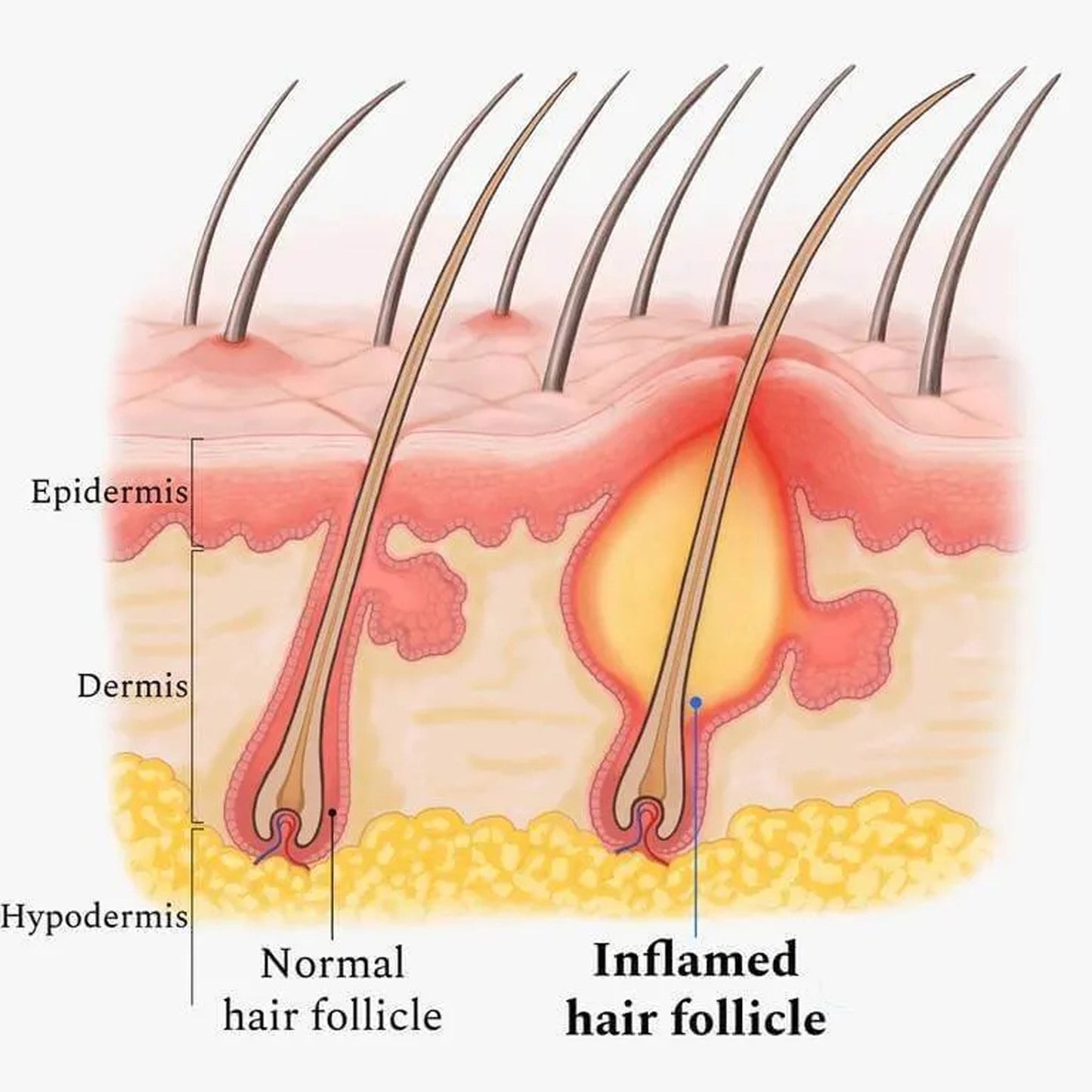 Scalp Deep Cleansing Recovery Oil